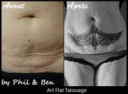 f - graphique - bas ventre - 001 COVER CIC