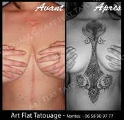 recouvrement cicatrices - poitrine + ventre - 001 S